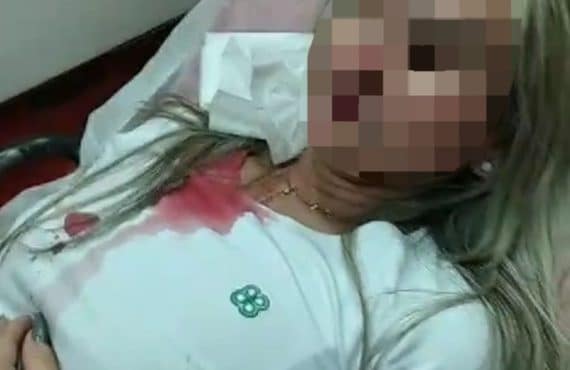 Mulher sofre pedrada na cabeça durante tentativa de assalto